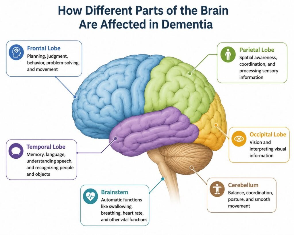 Infographic showing how dementia changes the brain by highlighting the frontal, temporal, parietal, occipital lobes, cerebellum, and brainstem and their functions.